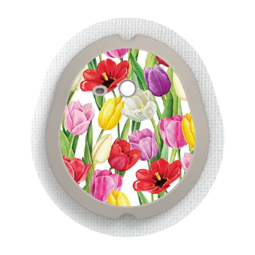Tulips